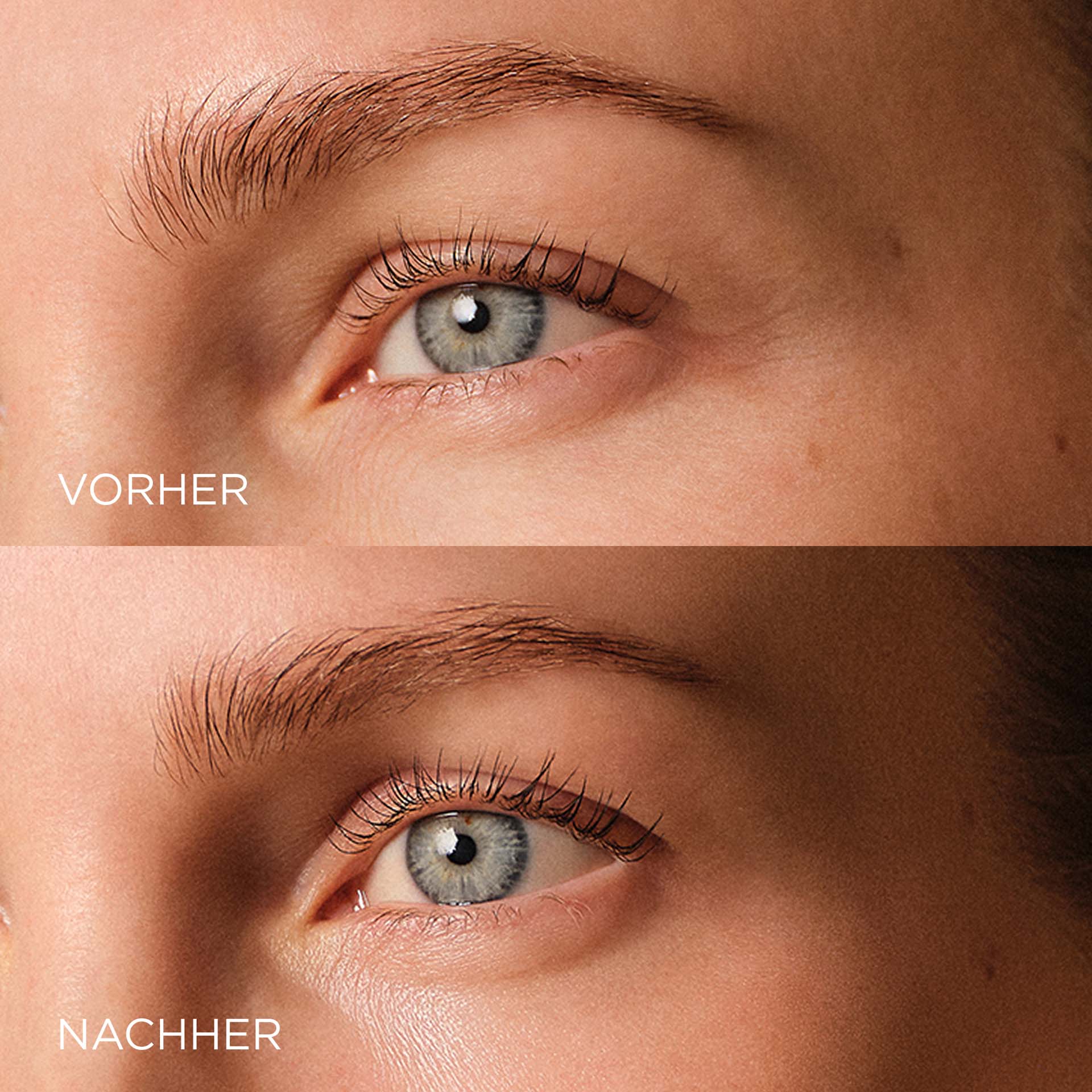 SYSTEM ABSOLUTE Glättende Augencreme Vorher Nachher